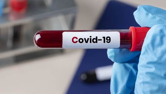 Image: Πώς η Covid-19 συνδέεται με αυξημένο κίνδυνο για αυτοάνοσα φλεγμονώδη ρευματικά νοσήματα