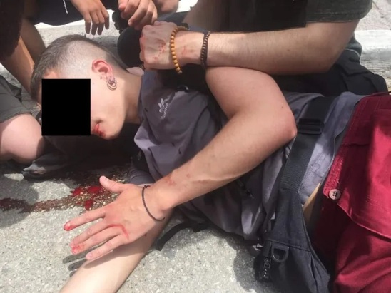 Image: AΠΘ: Αιμόφυρτος φοιτητής μετά από επίθεση των ΜΑΤ