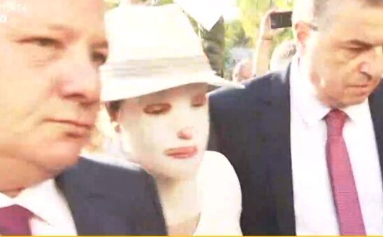 Image: Επίθεση με βιτριόλη: Με ειδική μάσκα στο εφετείο η Ιωάννα για τη δίκη – Πρώτη δημόσια εμφάνιση μετά την επίθεση